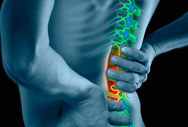 493x335 low back pain overview slideshow